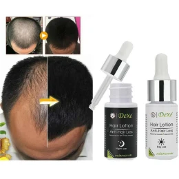Dexe Hair Lotion Anti-hair Loss Day & Night Essence (6 pcs Set)