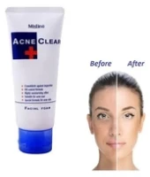Mistine Acne Scar Clear Oil Blemish Control Facial Foam Face Wash